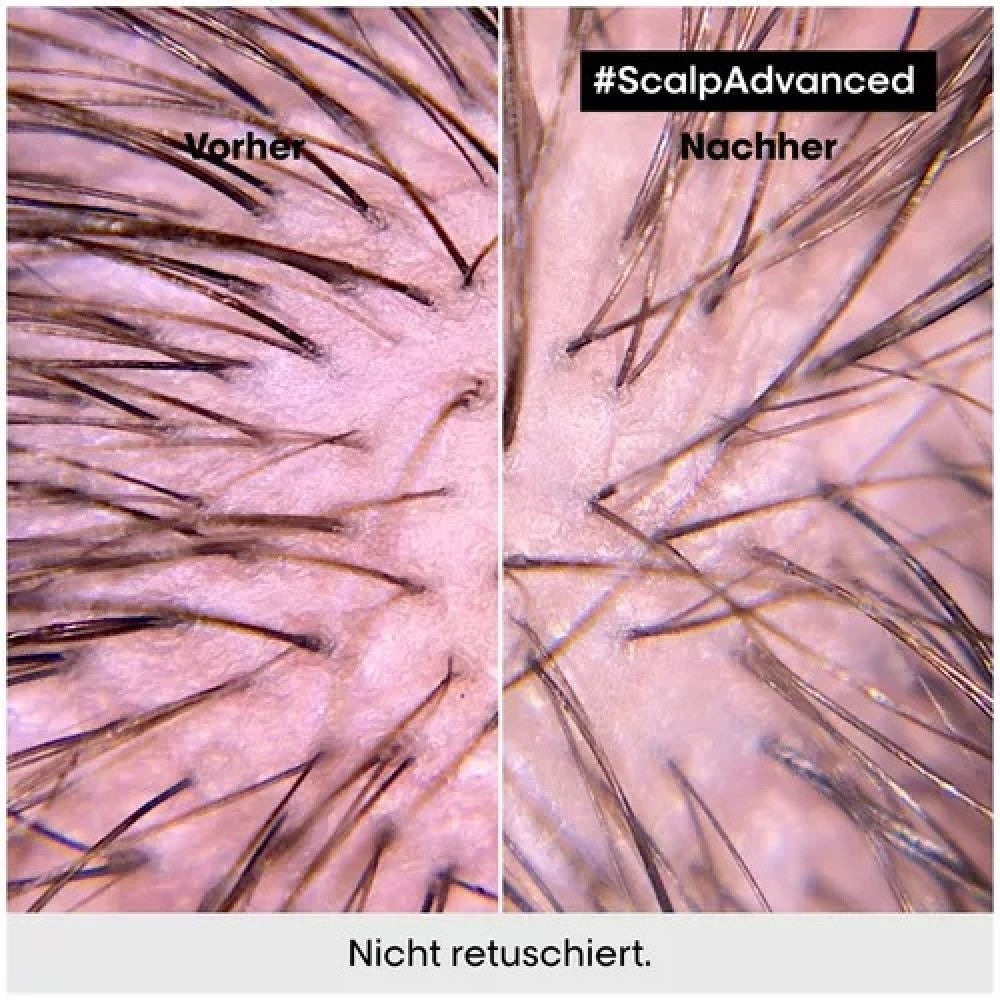 L'Oréal Professionnel Paris Série Expert Scalp Advanced Anti-Discomfort Intense Soother Treatment 200 ml